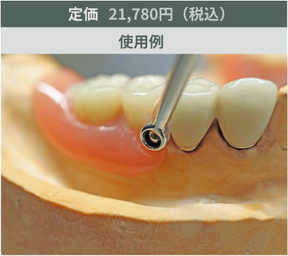 コーヌスリムーバー使用例